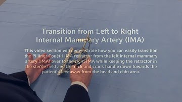 Pilling Couetil IMA Retractor Transition from Right IMA to Left IMA Instructional Video