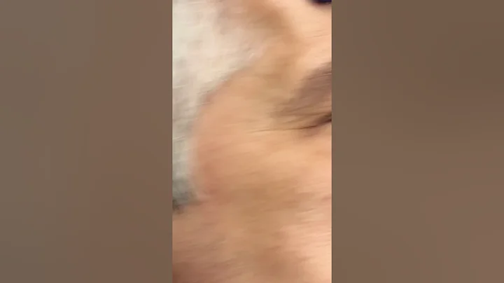 excel V Laser Genesis for cherry angiomas - Cynthia Golomb, MD