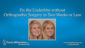 Fix the Underbite without Orthognathic Surgery in Two Weeks or Less