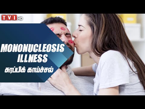 Mononucleosis Illness | சுரப்பிக் காய்ச்சல் | Dr.Rajes Logan | [Epi 140]