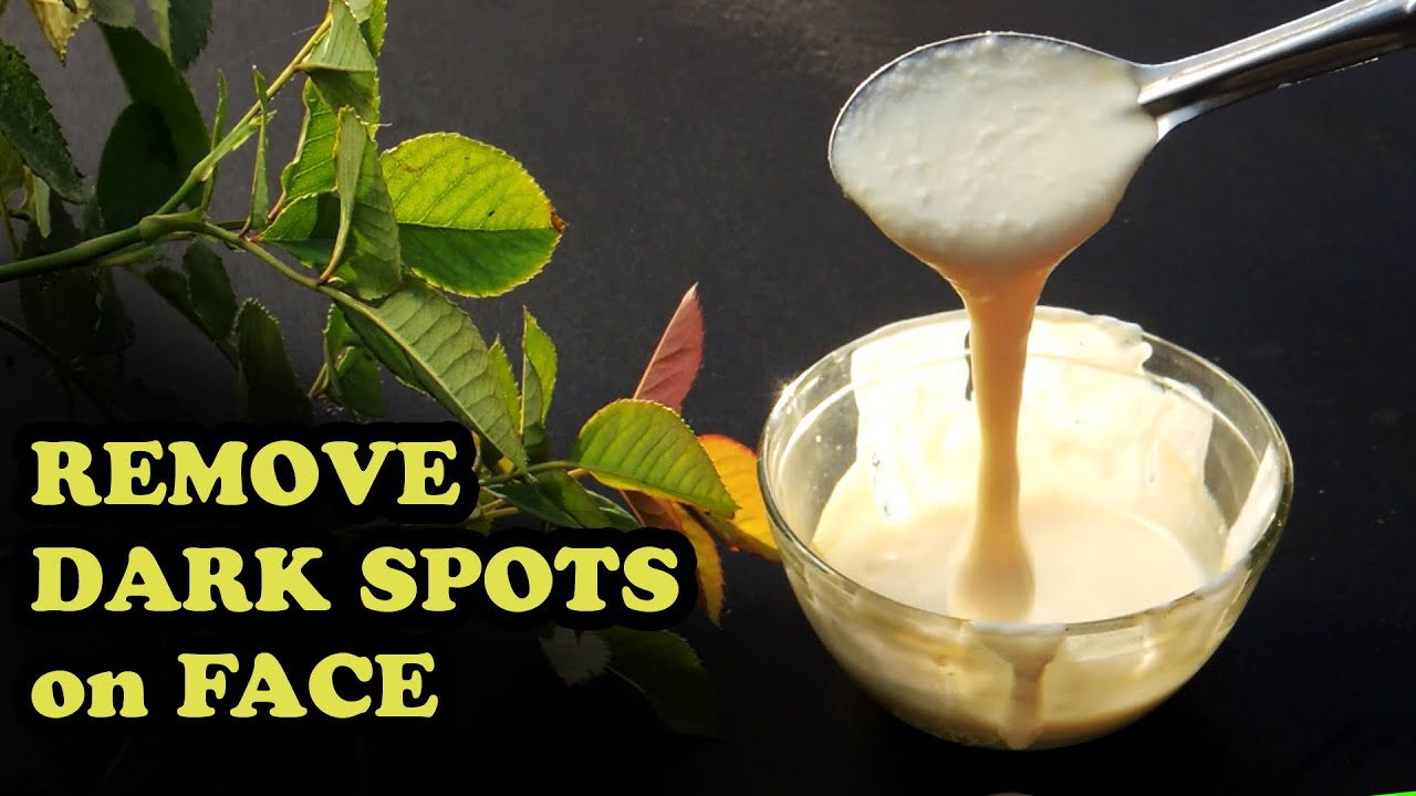 HOME REMEDIES TO REMOVE DARK SPOTS ON FACE NATURALLY | REMOVE DARK ACNE ...