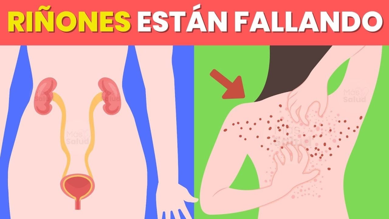 10 Señales De Que Tus Riñones Están Pidiendo Ayuda