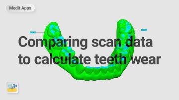 Comparing Scan Data to Calculate Teeth Wear with the Design App