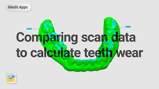 Comparing Scan Data to Calculate Teeth Wear with the Design App screenshot 4