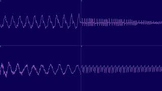 [Oscilloscope] Purple Motion - Jonne 1 - 5