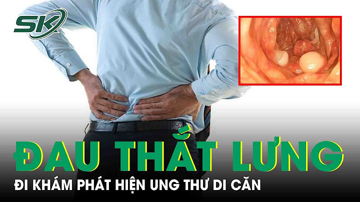 Rất dễ bị đau lưng là triệu chứng bệnh gì