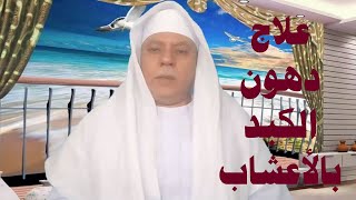 علاج دهون الكبد بالأعشاب