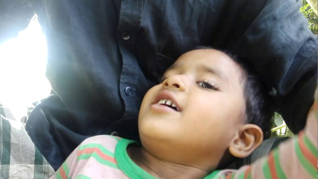 Here's the Boy ,After Circumcision how is his condition see this