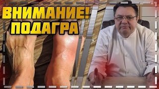 Внимание ! - подагра .Доктор Косов.