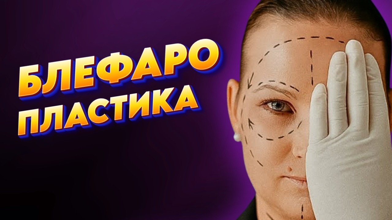 БЛЕФАРОПЛАСТИКА в вопросах и ответах от пластического хирурга Ксении Авдошенко