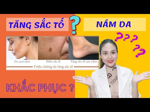 Video: Làm thế nào để tránh sắc tố da khi mang thai (có hình ảnh)