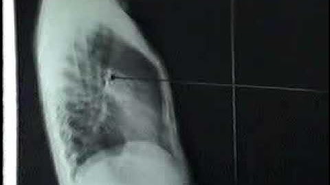 40 Hang do nam[bacsihoasung.wordpress.com].wmv