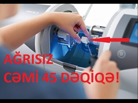 Video: Avtomobil üçün ən yaxşı diş çəkicilər hansıdır?