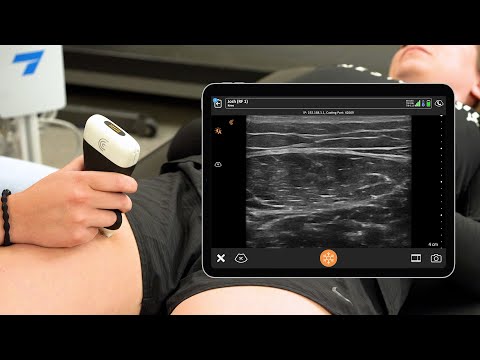 Image of Estimating Body Composition with Ultrasound