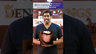 என்னது நாக்குல முடி வளருமா?😲😲 - Hairy Tongue | Denta Kings | Dr. Karthikeyan | Tamil