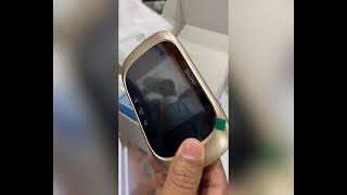 XOPO Digital Door Viewer Unboxing