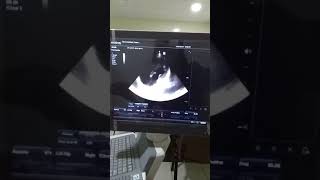 L - TGA   A case prepared by Prof.  Saleh Al-Awdhaly