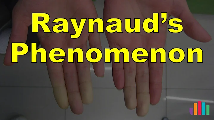 Raynaud's Phenomenon - DayDayNews