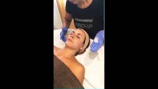 Microneedling: la tecnica n°1 di lifting non invasivo