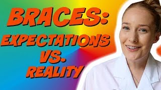 BRACES: EXPECTATIONS VS REALITY 2018