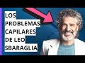 Leo Sbaraglia: la parte de su pelo que lo acompleja y el tratamiento que hace | #EnTerceraPersona