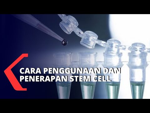 Video: Pemindahan Rambut Stem Cell: Apa Itu Dan Bilakah Ia Boleh Dilakukan?