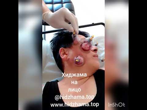 Video: Кантип бет маңдай жасалат