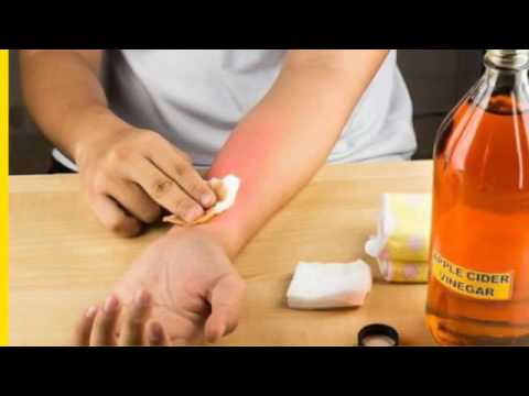 dermatologist skin tag removal cost