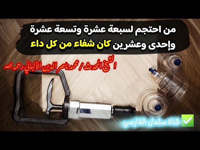 من احتجم لسبعة عشرة وتسعة عشرة وإحدى وعشرين كان شفاء من كل داء _ أفضل أيام الحجامة | للشيخ الألباني
