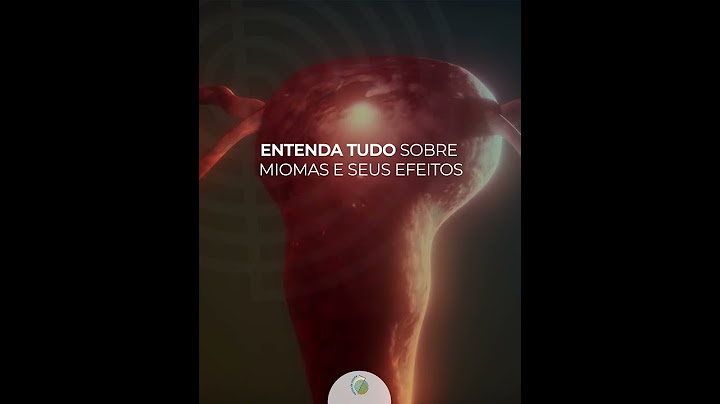 Entenda tudo sobre miomas e seus efeitos
