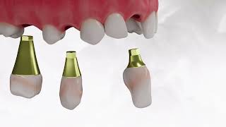 SIBASE Full Animation Video   Videos & Movies on Vimeo