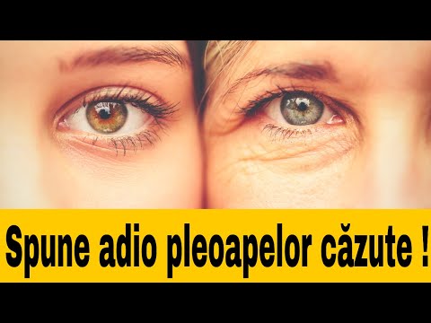 Spune adio pleoapelor căzute   Cum poți scăpa cu cel mai simplu leac natural posibil !?