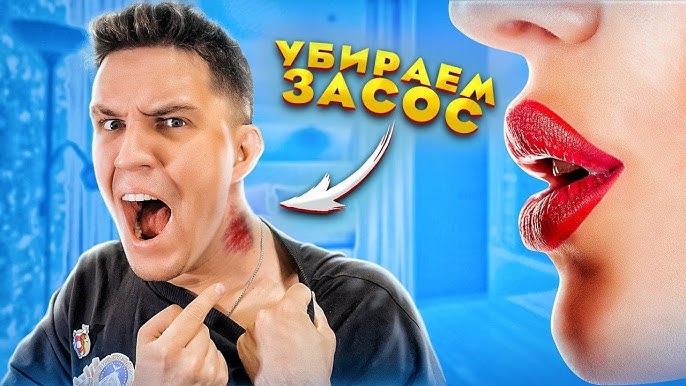 Засос — Википедия Засос — Википедия