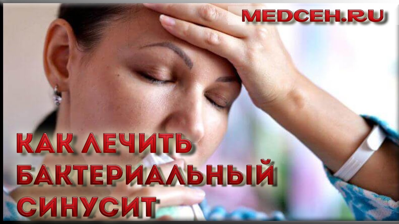 Как лечить синусит, бактериальный и вирусный Как лечить синусит, бактериальный и вирусный