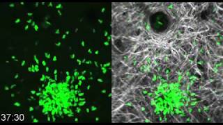 Neutrophils swarming to sites of injury