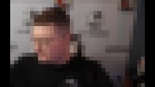 Super Real Anomaly Accidental Face Reveal Real Real