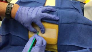 Chest Tube