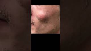 What Comes Out of This Cheek Will Shock You!