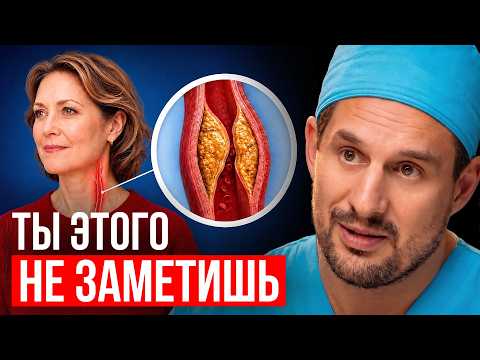 How to detect plaque before a stroke? Most often it's in the neck vessels, a must-watch!!!