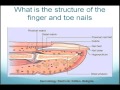 Nail Infections by Dr. Christopher Urban Pachyonychia Congenita