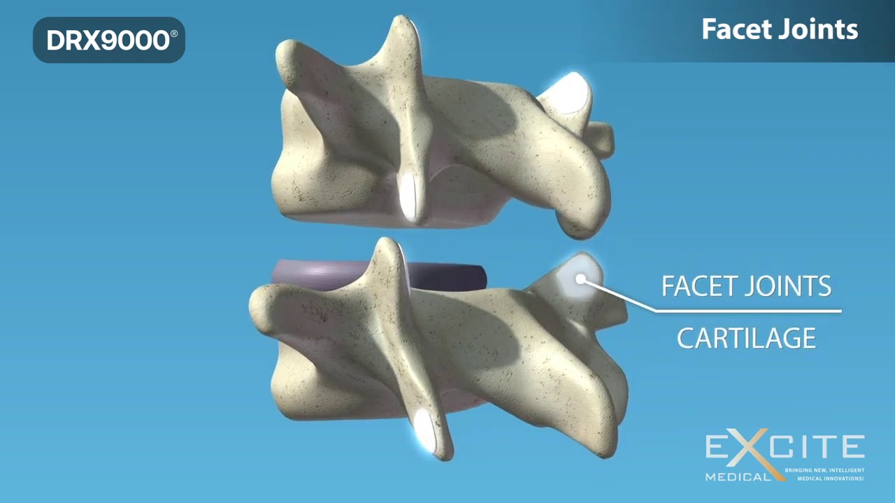 The DRX9000 Is The Most Advanced Non surgical Treatment For Back Pain the-drx9000-is-the-most-advanced-non-surgical-treatment-for-back-pain
