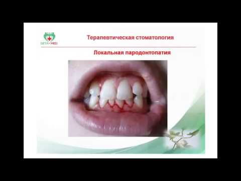 Терапевтическая стоматология и биорезонансная терапия