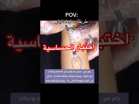 طريقة عمل اختبار الحساسية   اكسبلور لايك 