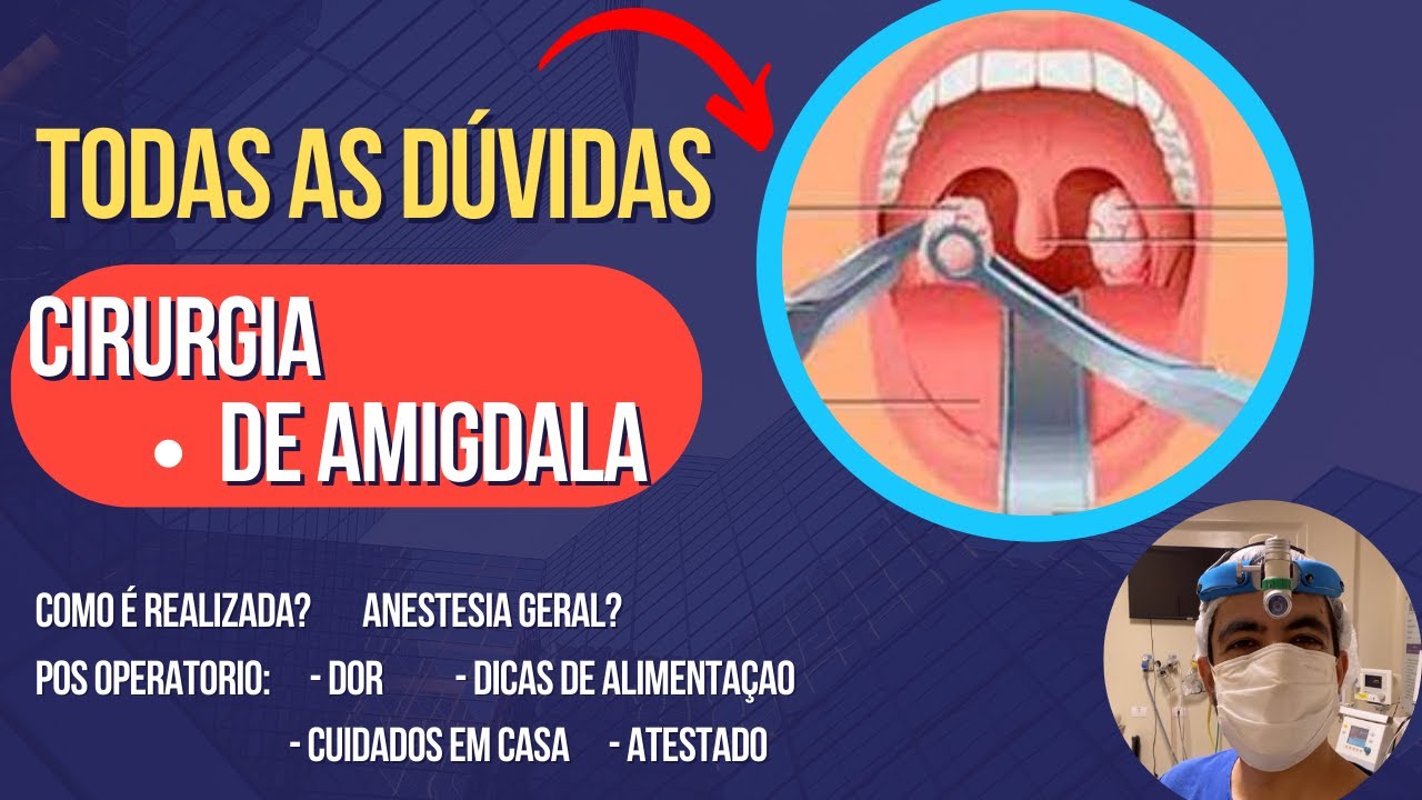Tudo sobre CIRURGIA DAS AMIGALAS: como é realizada, anestesia, pós  operatório e alimentaçāo /dieta, image size:1280x720