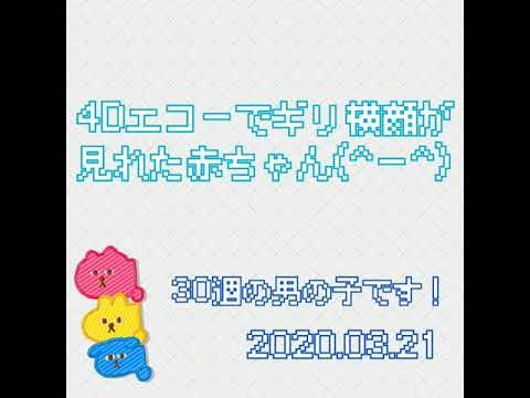 30週 4Dエコーでギリ横顔が見れた赤ちゃん (8ヶ月)