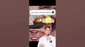 Răng cửa thưa phải làm sao | Dr Cường Offical #drcuong #shorts