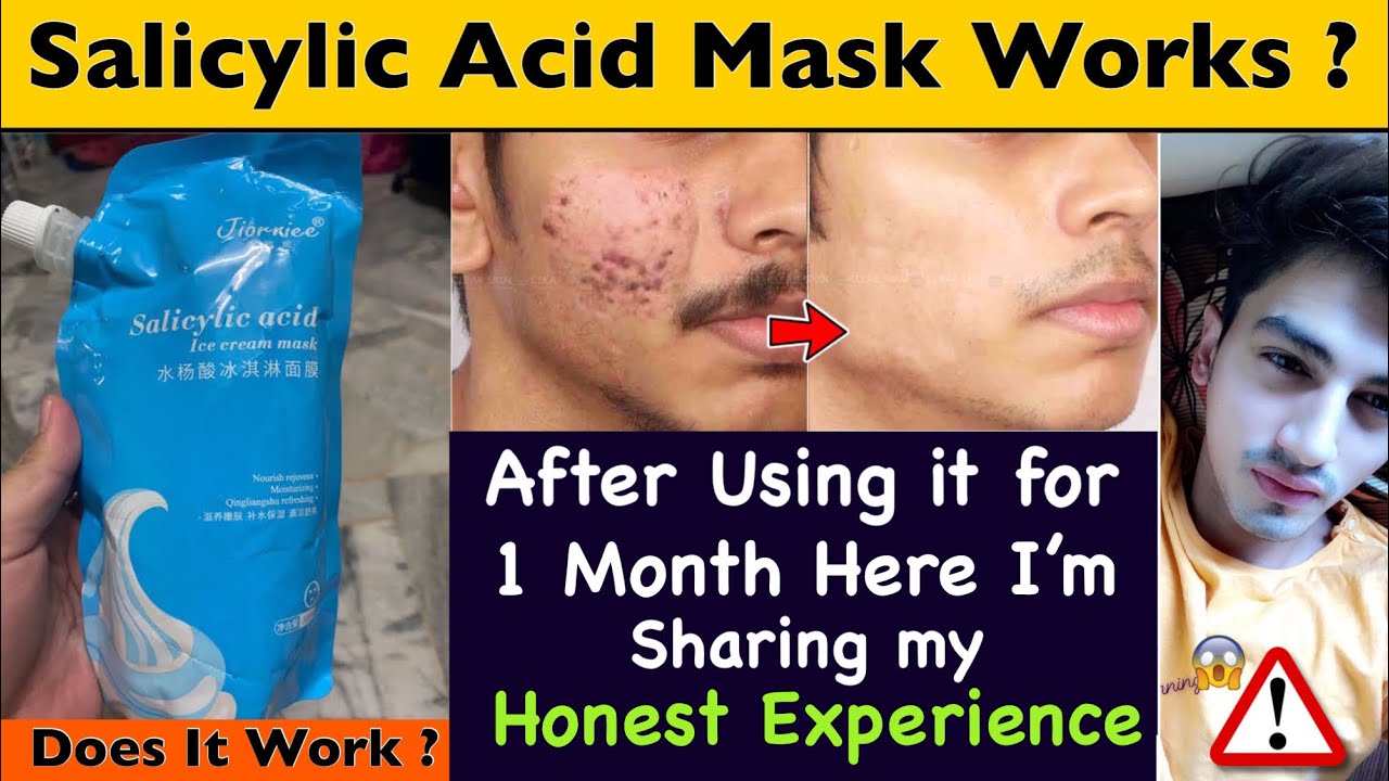 I tried salicylic acid ice cream mask for 1 month salicylic ice cream