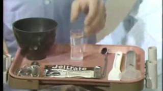 Edentulous Maxillary Alginate Impression Technique