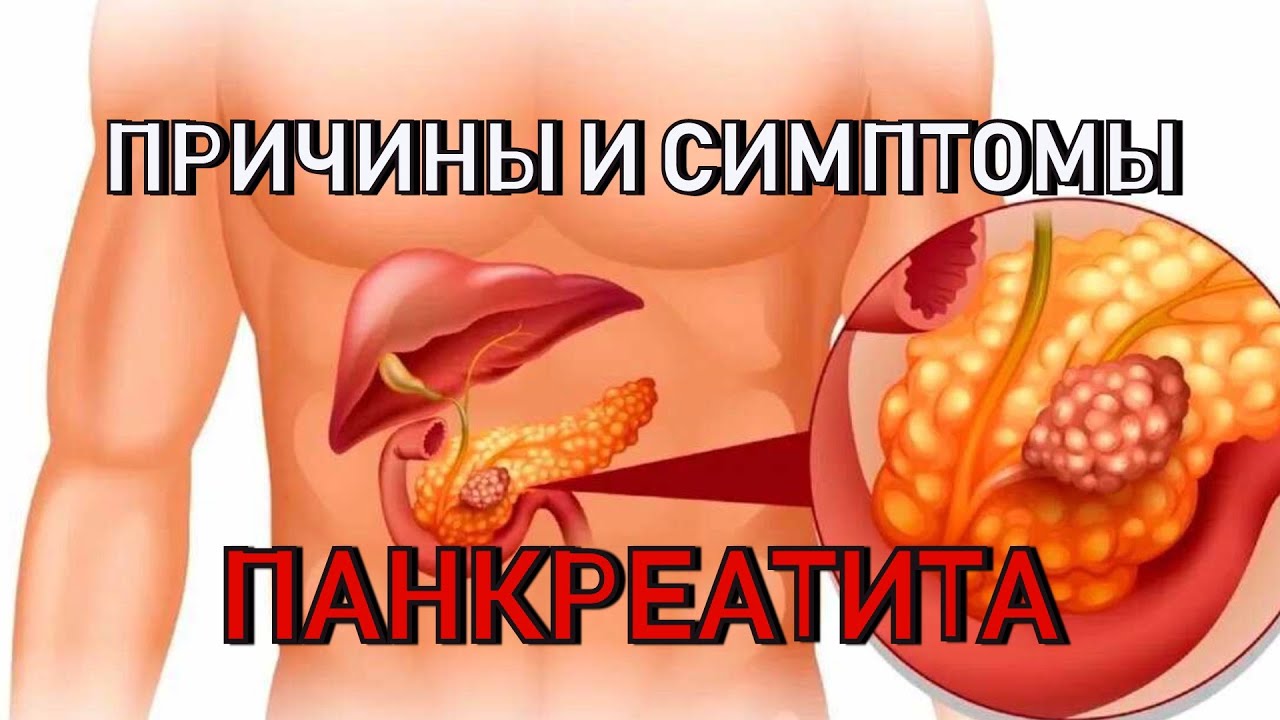 Можно Ли Заниматься Сексом При Панкреатите