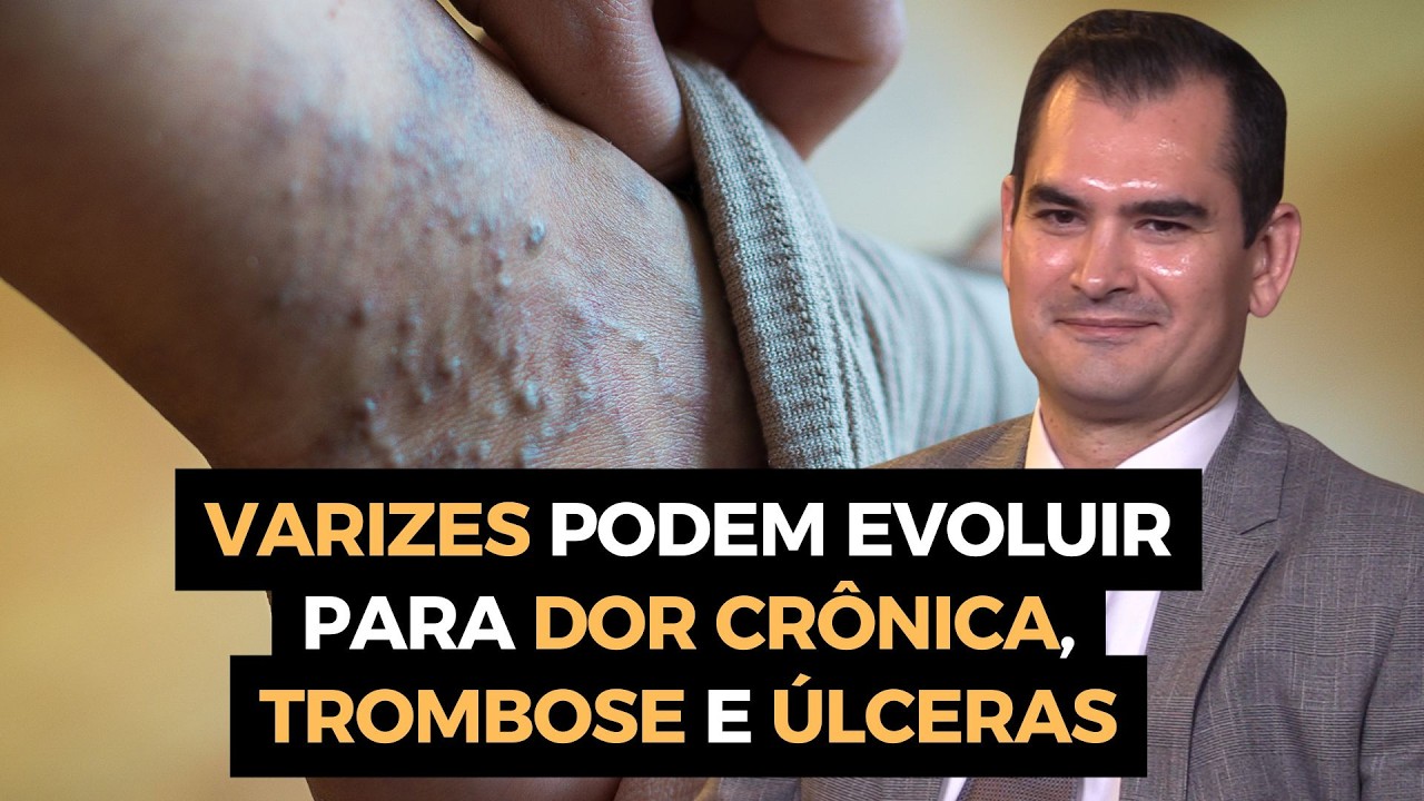 SAÚDE VASCULAR NÃO É ESTÉTICA. É SOBREVIVÊNCIA #020